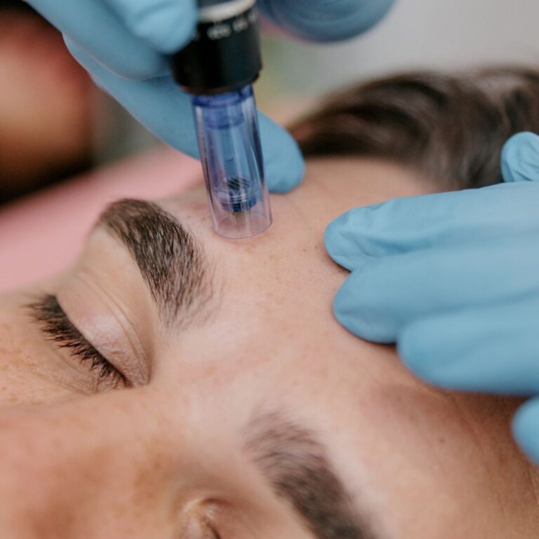 Exosomes Therapy Explained: How It's Revolutionizing Skin Rejuvenation